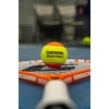 image:imageGAMMA Quick Kids Training Tennis Balls for Kids amp Beginners LowCompression Core Reduces Speed amp Bounce Great for Tennis Practice USTA amp ITF Approved for 10 amp Under Tournaments Parent12 Bag